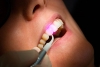 Преимущества лечения зубов лазером. Показания и противопоказания к лазеротерапии и лазерной хирургии в стоматологии.